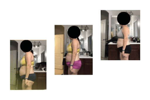 Before, during, and after shots of woman experiencing the benefits of medical weight loss